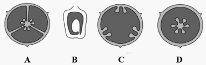 Question diagram