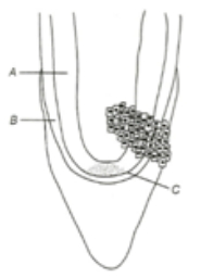 Question diagram