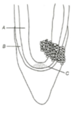 Question diagram