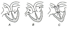 Question diagram