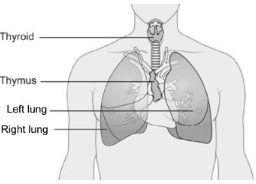 Solution diagram