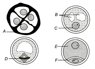 Question diagram