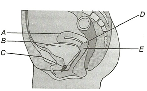 Question diagram