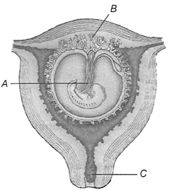 Question diagram