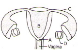 Question diagram