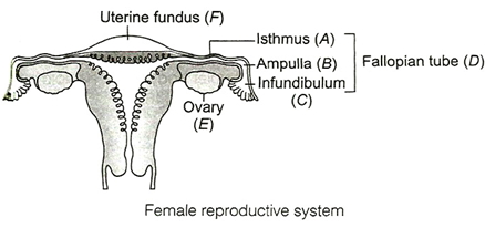 Solution diagram