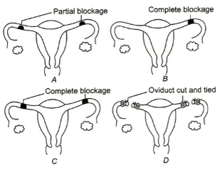 Question diagram