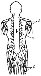 Question diagram