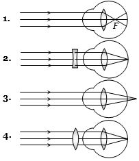 Question diagram