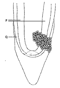 Question diagram