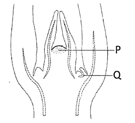 Question diagram