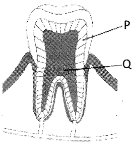 Question diagram
