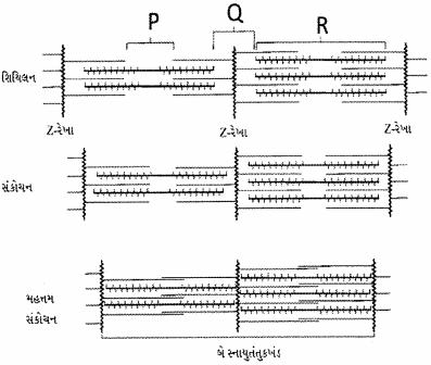 Question diagram