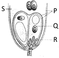 Question diagram