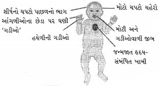 Question diagram