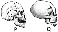Question diagram