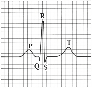 Question diagram