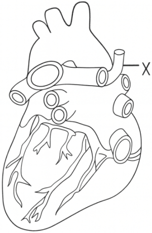 Question diagram