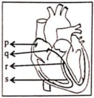 Question diagram