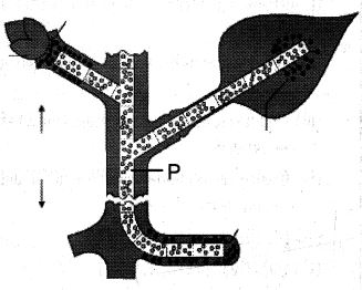 Question diagram