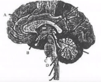 Question diagram