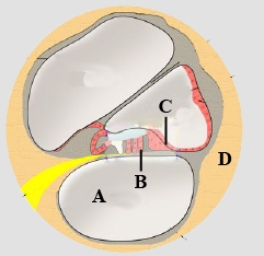 Question diagram