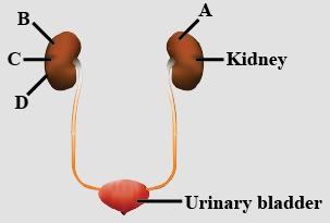 Question diagram