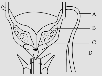 Question diagram