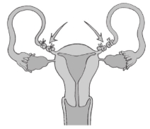 Question diagram