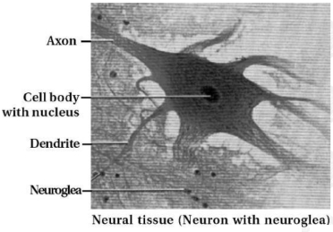 Question diagram