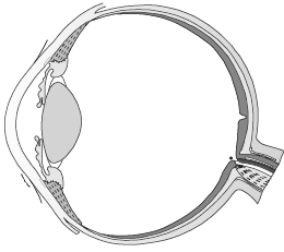 Question diagram