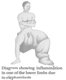 Solution diagram