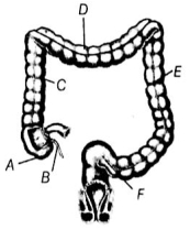 Question diagram